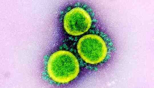 A microscopic image of the SARS-CoV-2 virus that causes COVID-19