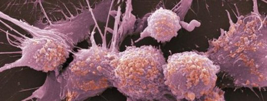 How Cancer Eats Itself To Survive Our Therapies