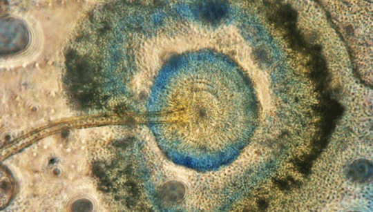 Aspergillus niger, the fungal dandelion Michael Taylor
