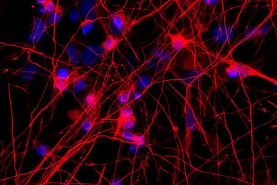 This One Gene Error Is Linked To Early-Onset Dementia