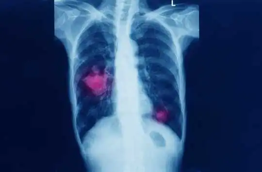 What Exactly Is A Disease?
