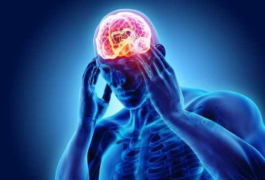 Why The Cluster Headache Is More Than Just A Headache