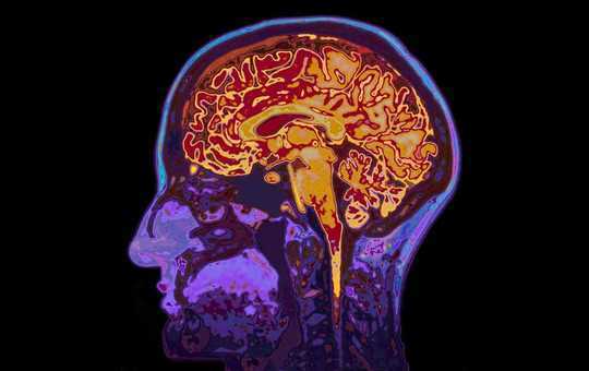 Five Amazing Facts About Your Brain