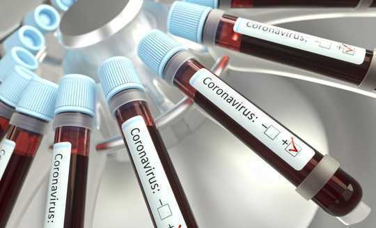 How Coronavirus Is Upsetting The Blood Supply Chain
