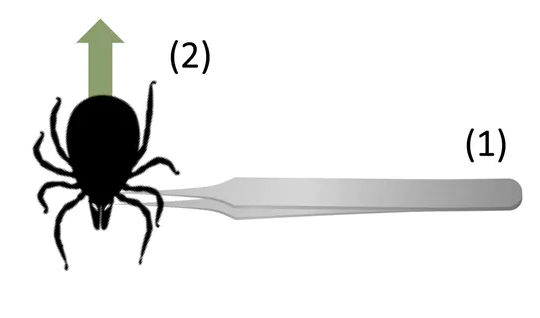 How to properly remove an attached tick.