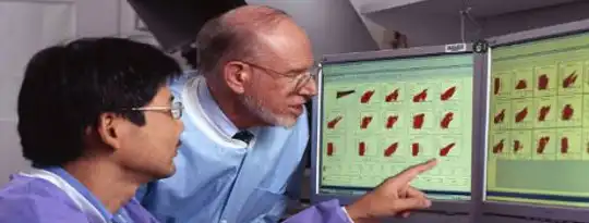 Classification Of Endometrial Tumors Could Guide Treatment