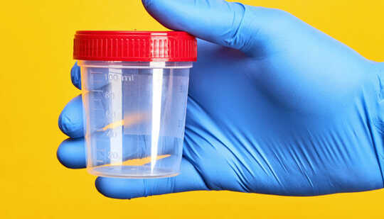 A blue-gloved hand holds a urine test cup with a red lid