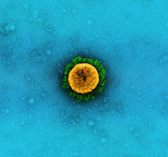 Electron micrograph of a yellow virus particle with green spikes, against a blue background.